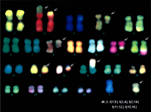 Normal chromosomes