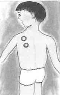 妹の様子（石橋紀久子作）